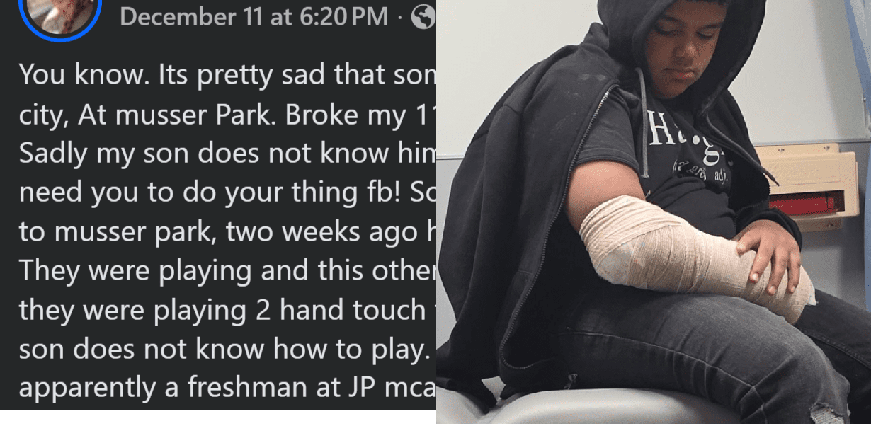 JP McCaskey Freshman Allegedly Breaks Child’s Arm During Football at Musser Park in Lancaster City