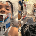 Mom Outraged After Son Lenny Suffers Skull Fracture in Gym Class Assault School Waited Hours to Call Police and Let Attacker Return to Class
